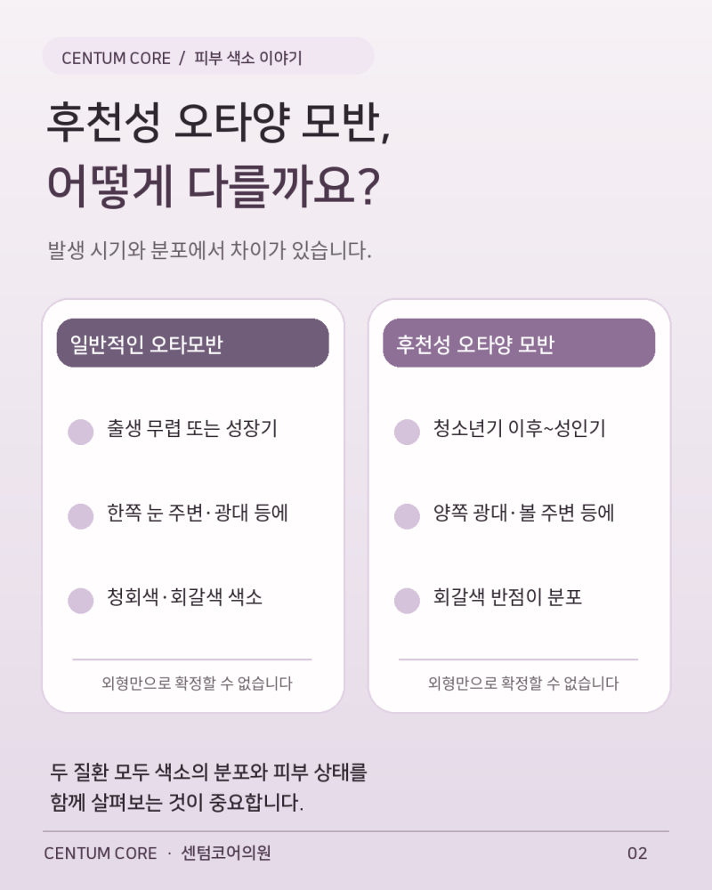 해운대오타모반,앙쪽 광대에 비슷한 색소가 생겼다면?후천성오타모반 알아보기 사진 3